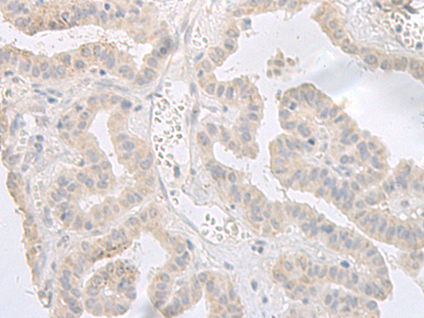 Rabbit Polyclonal Antibody to GPRASP2
