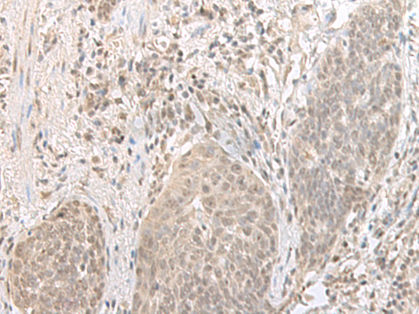 Rabbit Polyclonal Antibody to ORC1