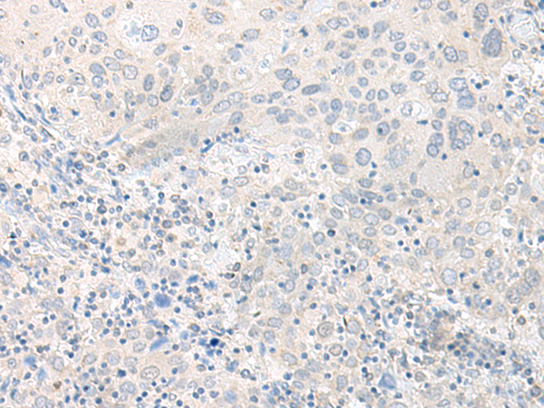Rabbit Polyclonal Antibody to TIMM8A