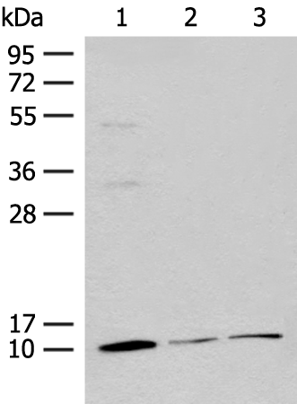 Rabbit Polyclonal Antibody to RPS27L