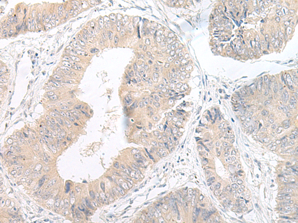 Rabbit Polyclonal Antibody to LYRM2