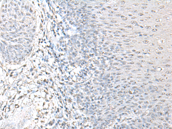 Rabbit Polyclonal Antibody to EPM2A