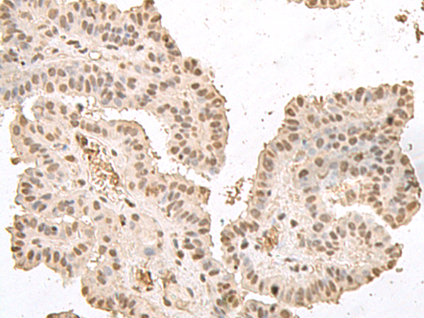 Rabbit Polyclonal Antibody to HMGN2