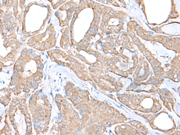 Rabbit Polyclonal Antibody to C9orf116