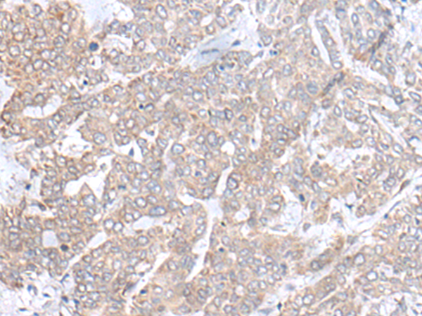 Rabbit Polyclonal Antibody to PLGLB2