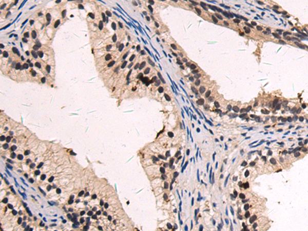 Rabbit Polyclonal Antibody to DPY30