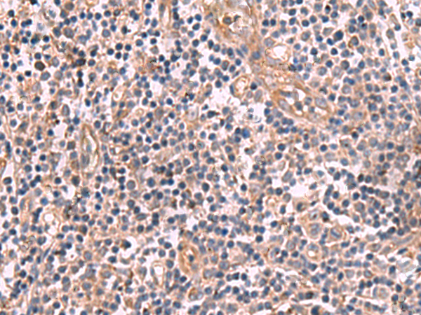 Rabbit Polyclonal Antibody to MGP