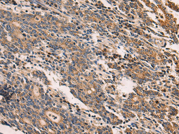 Rabbit Polyclonal Antibody to MRPS36