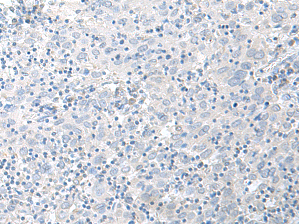 Rabbit Polyclonal Antibody to STAU2