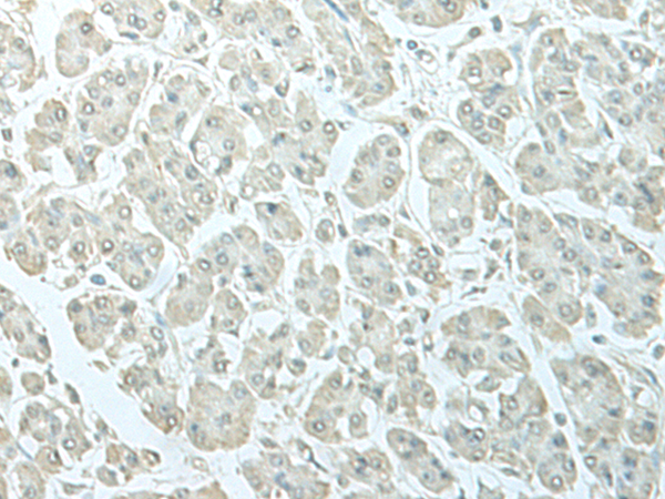 Rabbit Polyclonal Antibody to TCIM
