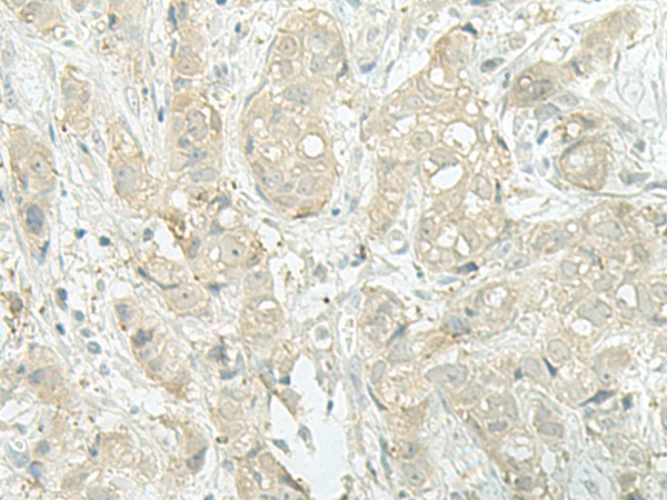 Rabbit Polyclonal Antibody to MIEN1