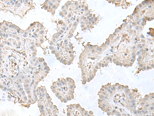 Rabbit Polyclonal Antibody to LSM10