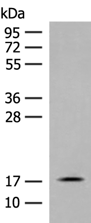 Rabbit Polyclonal Antibody to RPS25