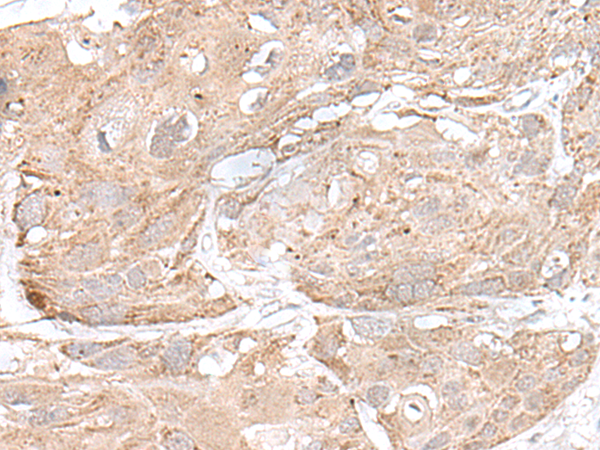 Rabbit Polyclonal Antibody to SNRNP25
