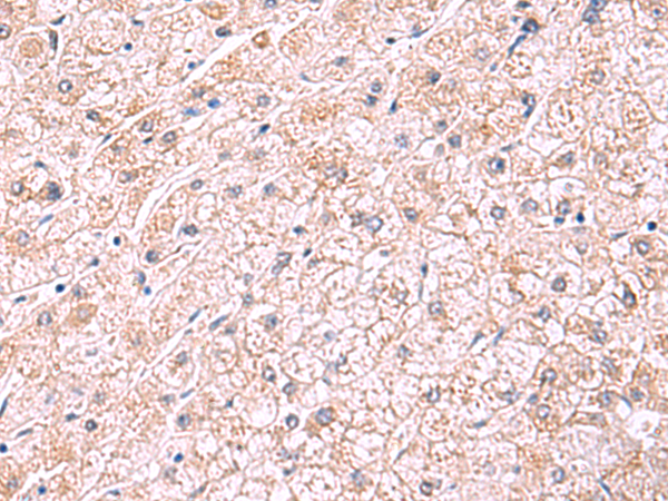 Rabbit Polyclonal Antibody to PDRG1