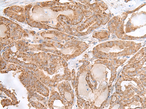 Rabbit Polyclonal Antibody to RPL28