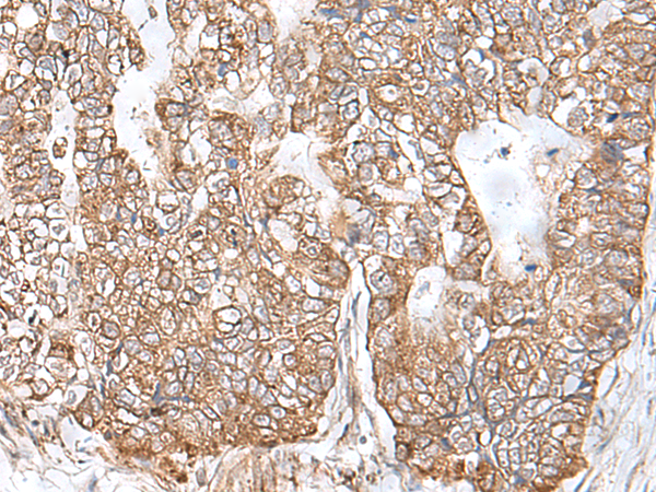 Rabbit Polyclonal Antibody to RNF111