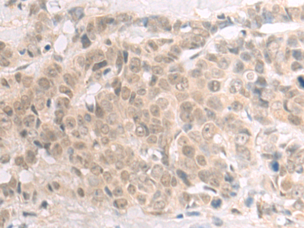 Rabbit Polyclonal Antibody to POLR2D
