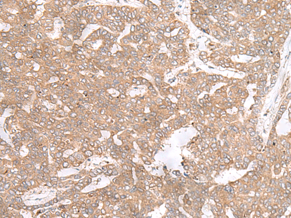 Rabbit Polyclonal Antibody to PTP4A3