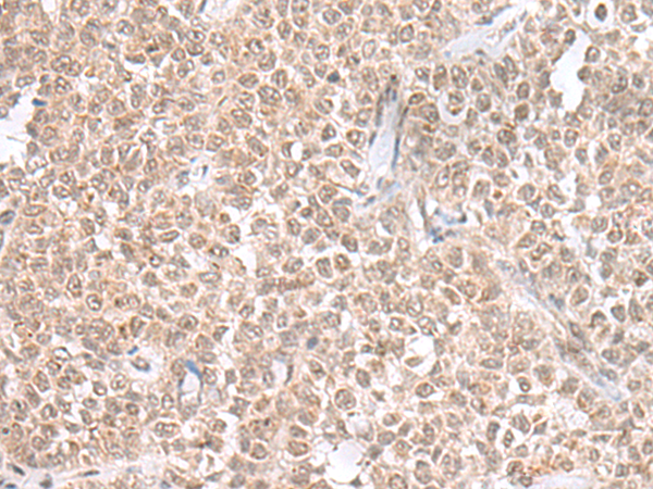 Rabbit Polyclonal Antibody to THAP12