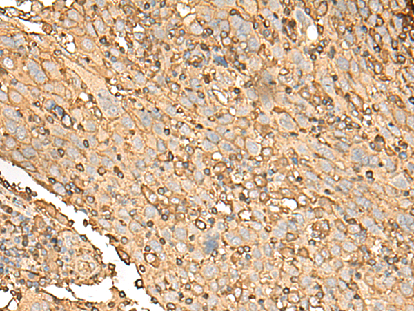 Rabbit Polyclonal Antibody to UBE2A