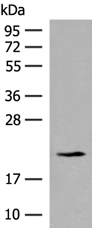 Rabbit Polyclonal Antibody to RPL23A