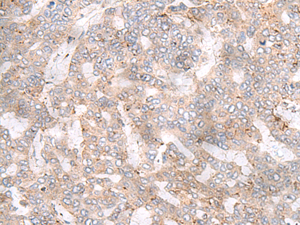 Rabbit Polyclonal Antibody to GLYAT