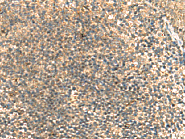 Rabbit Polyclonal Antibody to TCAP