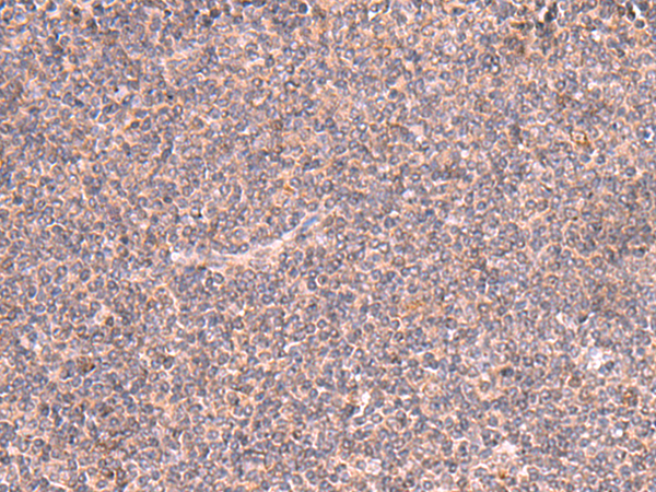 Rabbit Polyclonal Antibody to MRPS24