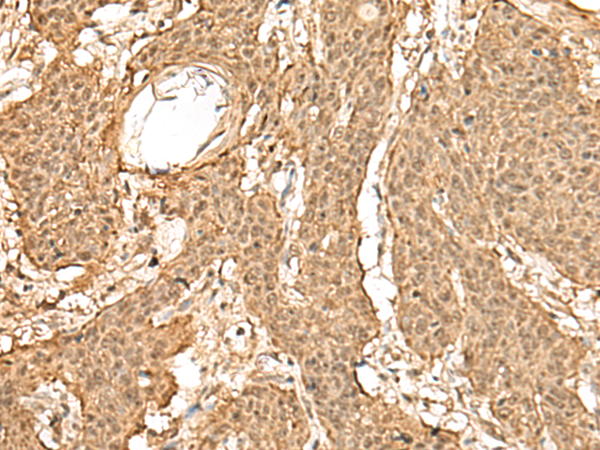 Rabbit Polyclonal Antibody to TIPRL