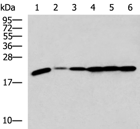 Rabbit Polyclonal Antibody to RPL17