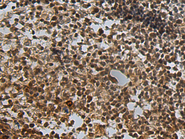 Rabbit Polyclonal Antibody to N6AMT1