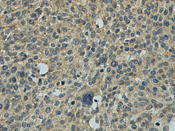 Rabbit Polyclonal Antibody to USP53