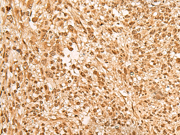 Rabbit Polyclonal Antibody to JPT2