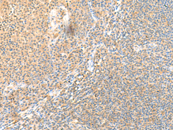 Rabbit Polyclonal Antibody to SSC4D
