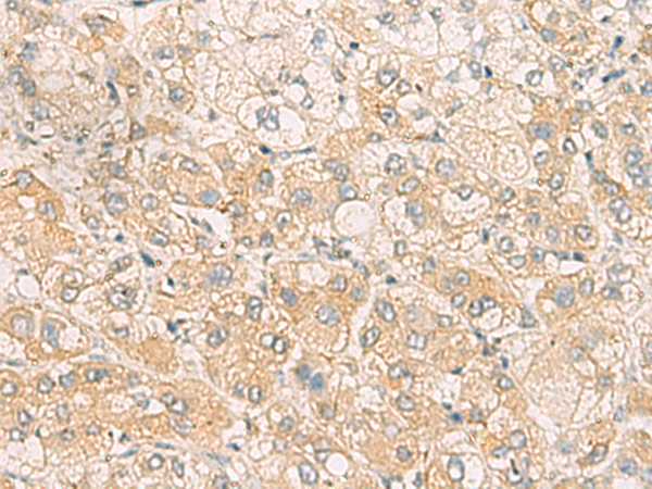 Rabbit Polyclonal Antibody to SYNGR1