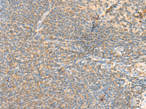 Rabbit Polyclonal Antibody to RHOH