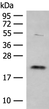 Rabbit Polyclonal Antibody to TIMM22