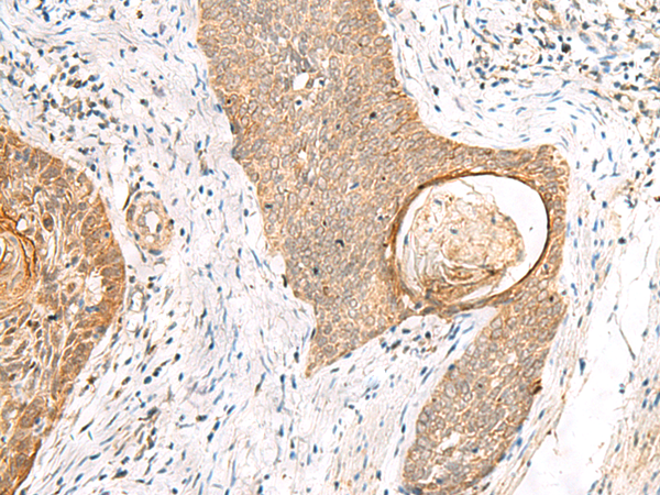 Rabbit Polyclonal Antibody to TOR1A