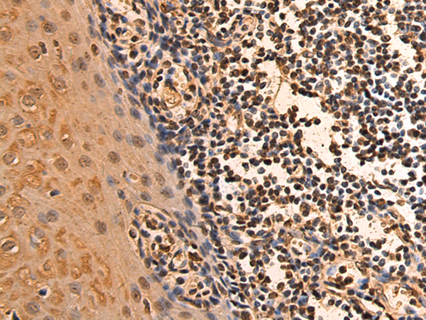 Rabbit Polyclonal Antibody to TMA16