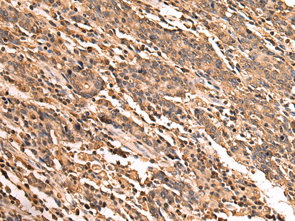 Rabbit Polyclonal Antibody to RAB29