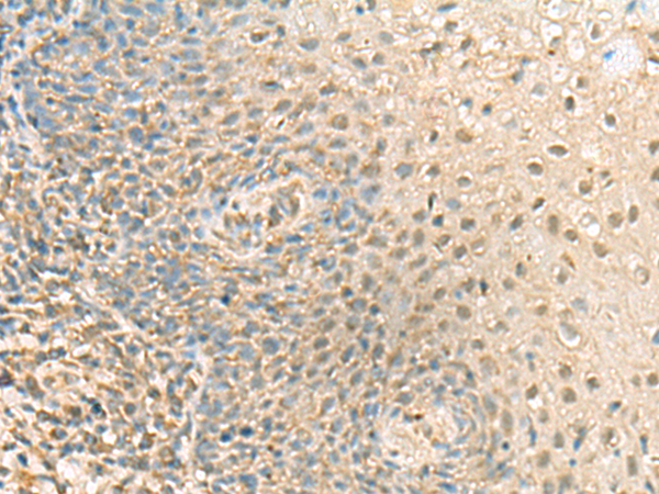 Rabbit Polyclonal Antibody to PPCDC