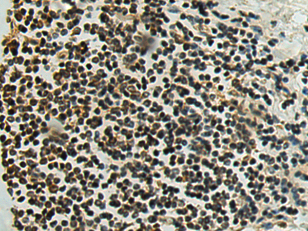 Rabbit Polyclonal Antibody to PSMB3