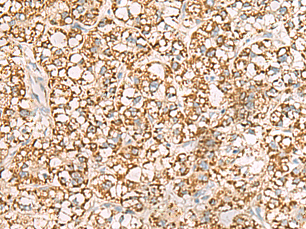 Rabbit Polyclonal Antibody to ISOC2