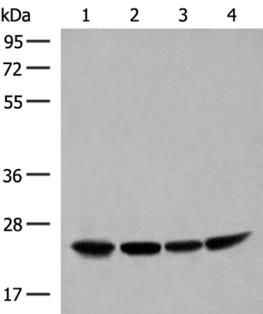 Rabbit Polyclonal Antibody to DTYMK
