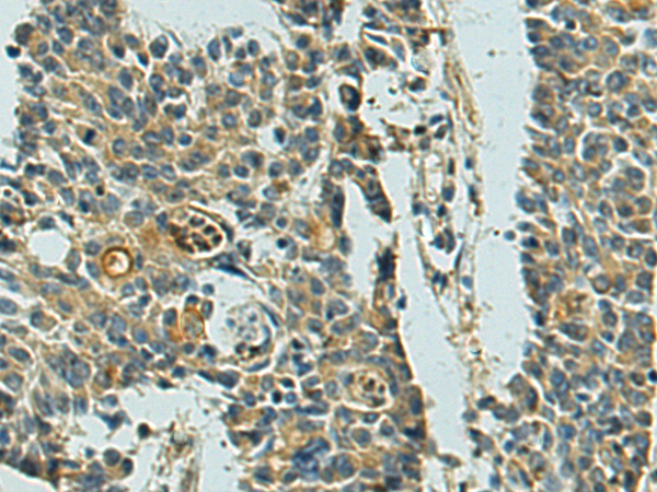 Rabbit Polyclonal Antibody to MRPL48