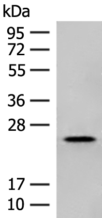 Rabbit Polyclonal Antibody to NXNL1