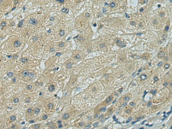 Rabbit Polyclonal Antibody to RPL10L