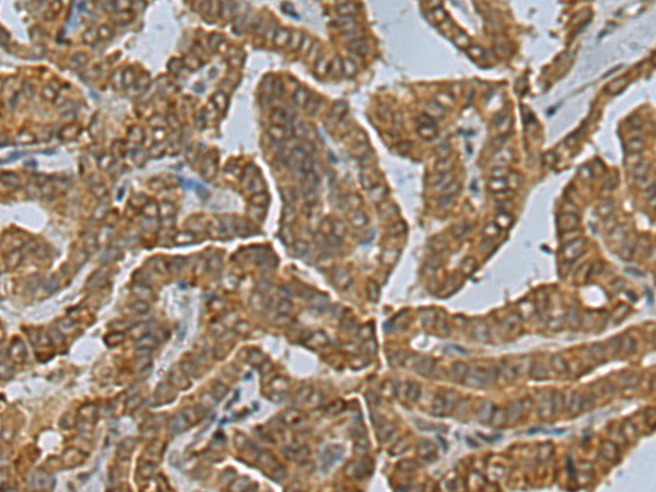 Rabbit Polyclonal Antibody to ANKRD10
