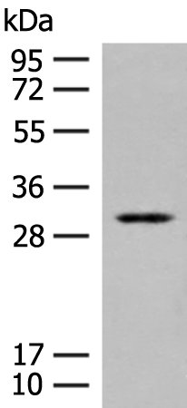 Rabbit Polyclonal Antibody to TPMT